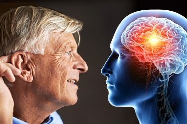 رابطه کم شنوایی و آلزایمر